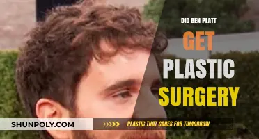 Did Ben Platt Undergo Plastic Surgery? Examining the Rumors and Facts