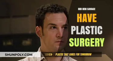 Ben Savage Plastic Surgery: Fact-Checking the Rumors and Speculations