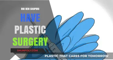 Ben Shapiro Plastic Surgery: Fact-Checking the Rumors and Speculations