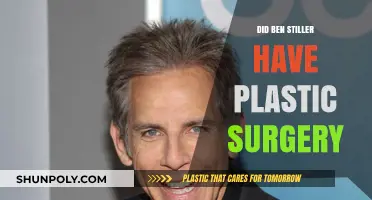 Ben Stiller's Transformation: Plastic Surgery Rumors Explored and Debunked