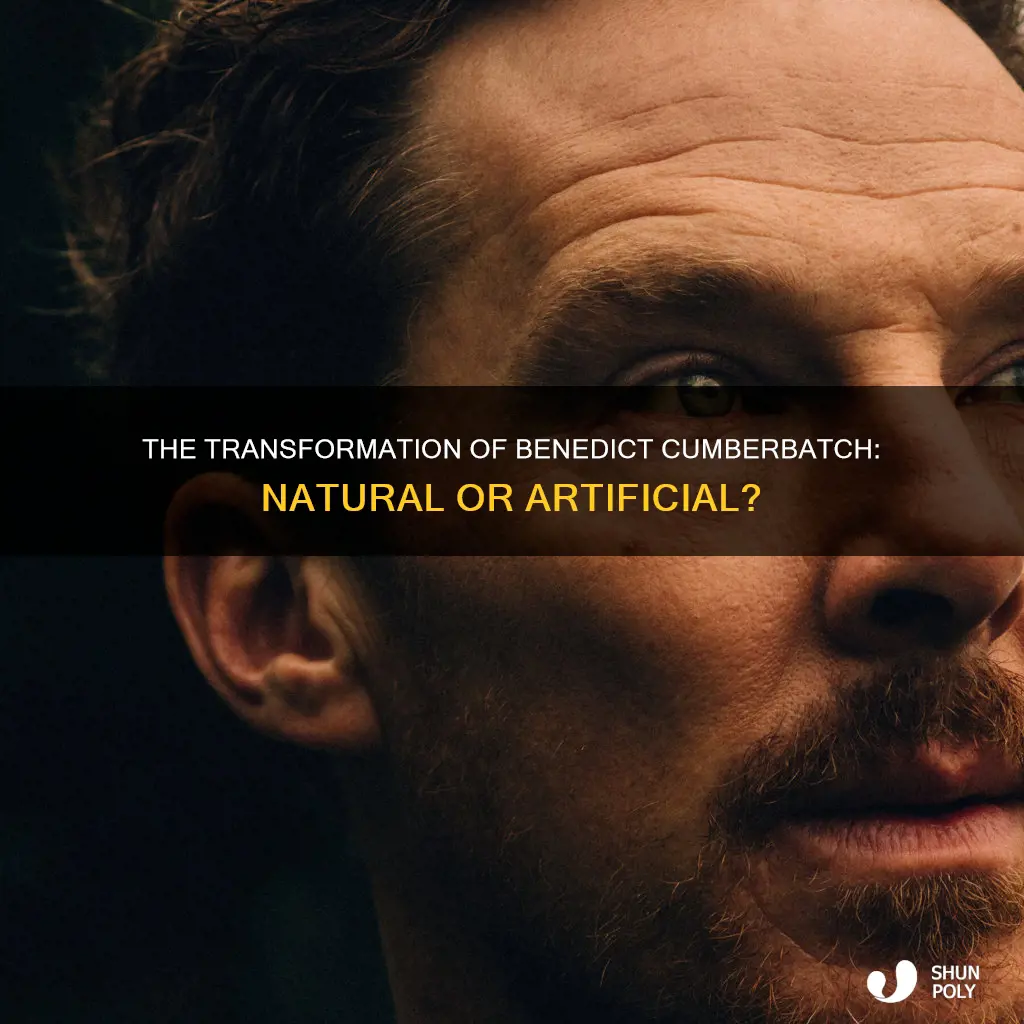 did benedict cumberbatch have plastic surgeru