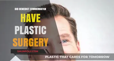 Benedict Cumberbatch Plastic Surgery Rumors: Fact or Fiction?