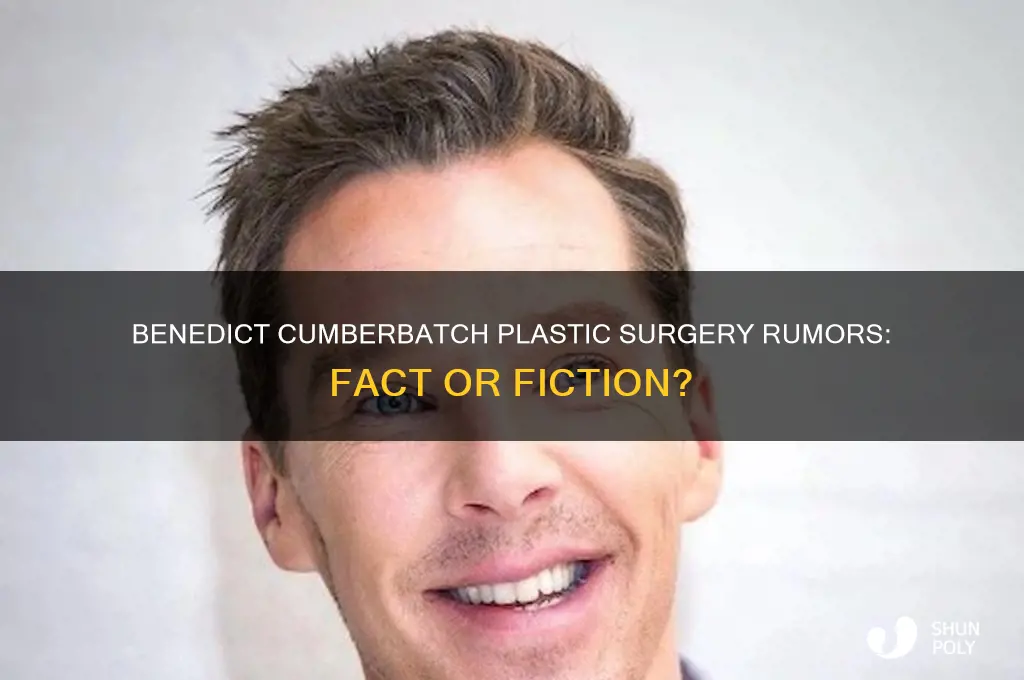 did benedict cumberbatch have plastic surgery
