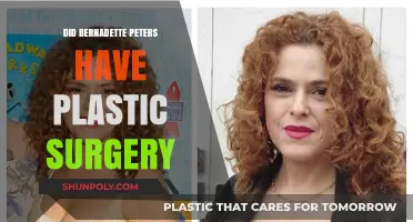 Bernadette Peters Plastic Surgery: Fact-Checking the Rumors and Speculations