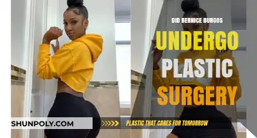 Bernice Burgos Plastic Surgery: Fact-Checking Her Transformation Rumors