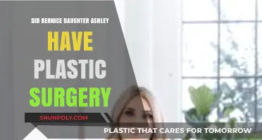 Ashley's Transformation: Plastic Surgery Speculations Surrounding Bernice's Daughter