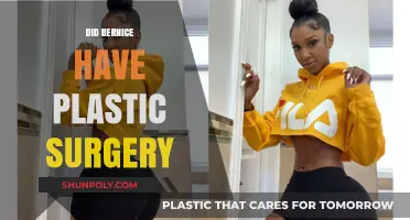 Did Bernice Undergo Plastic Surgery? Uncovering the Truth Behind Her Transformation