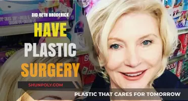 Beth Broderick's Transformation: Plastic Surgery Speculations and Truths
