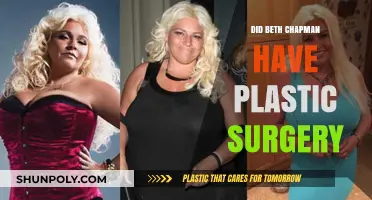 Beth Chapman's Transformation: Plastic Surgery Speculations and Truths Revealed