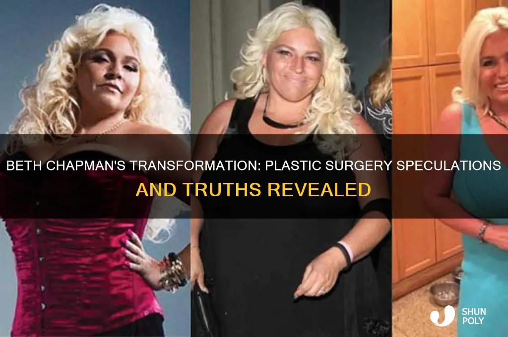 did beth chapman have plastic surgery