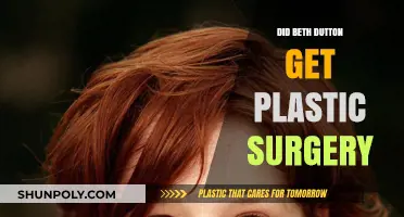 Beth Dutton's Transformation: Plastic Surgery Speculations and Truths Revealed