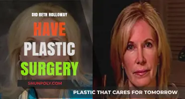 Beth Holloway Plastic Surgery: Fact-Checking the Rumors and Speculations