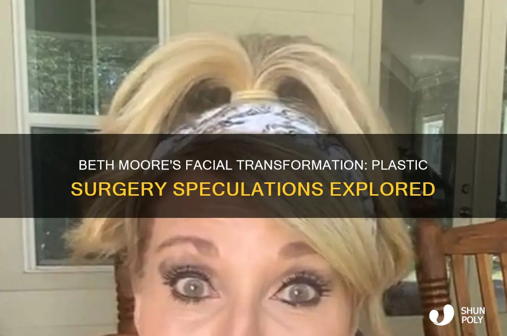 did beth moore get plastic surgery on her face