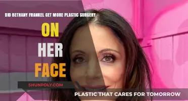 Bethany Frankel's Face: New Plastic Surgery Speculations Explored