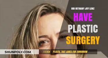 Bethany Joy Lenz Plastic Surgery: Fact-Checking the Rumors and Speculations