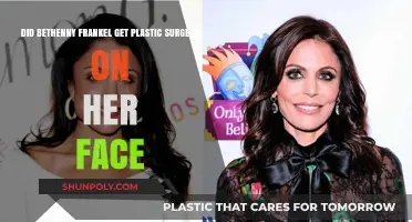 Bethenny Frankel's Face: Natural Beauty or Plastic Surgery?