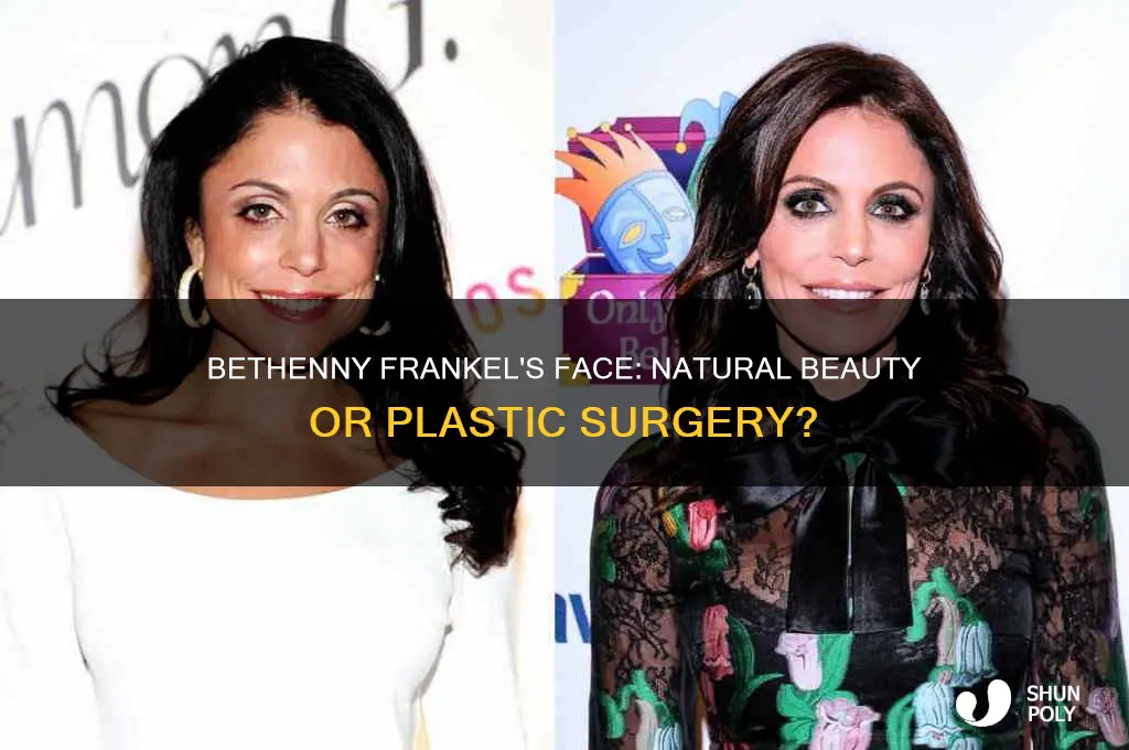 did bethenny frankel get plastic surgery on her face