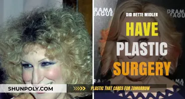 Bette Midler's Transformation: Plastic Surgery Rumors and Reality Revealed