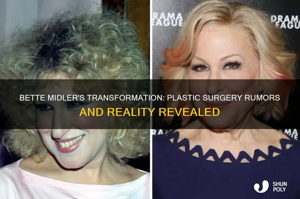 did bette midler have plastic surgery