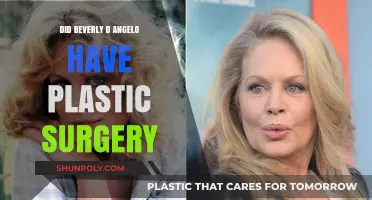 Beverly D'Angelo's Transformation: Plastic Surgery Rumors Explored