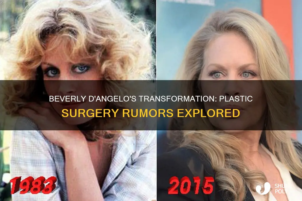 did beverly d angelo have plastic surgery