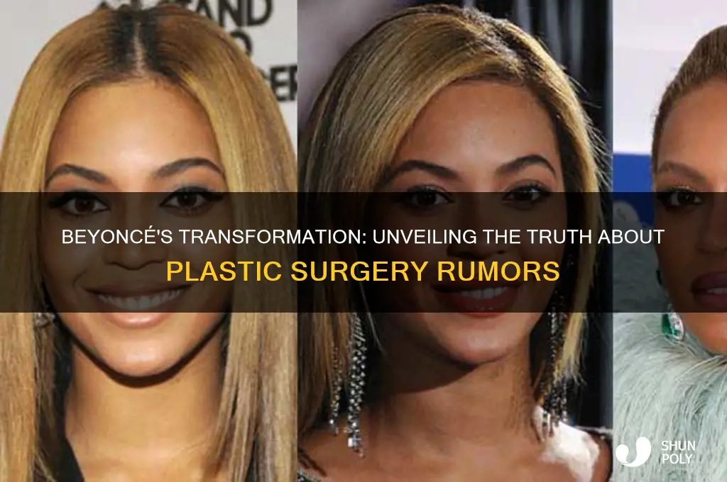 did beyonce do plastic surgery