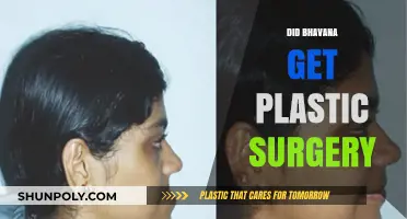 Bhavana's Transformation: Plastic Surgery Rumors and the Truth Revealed