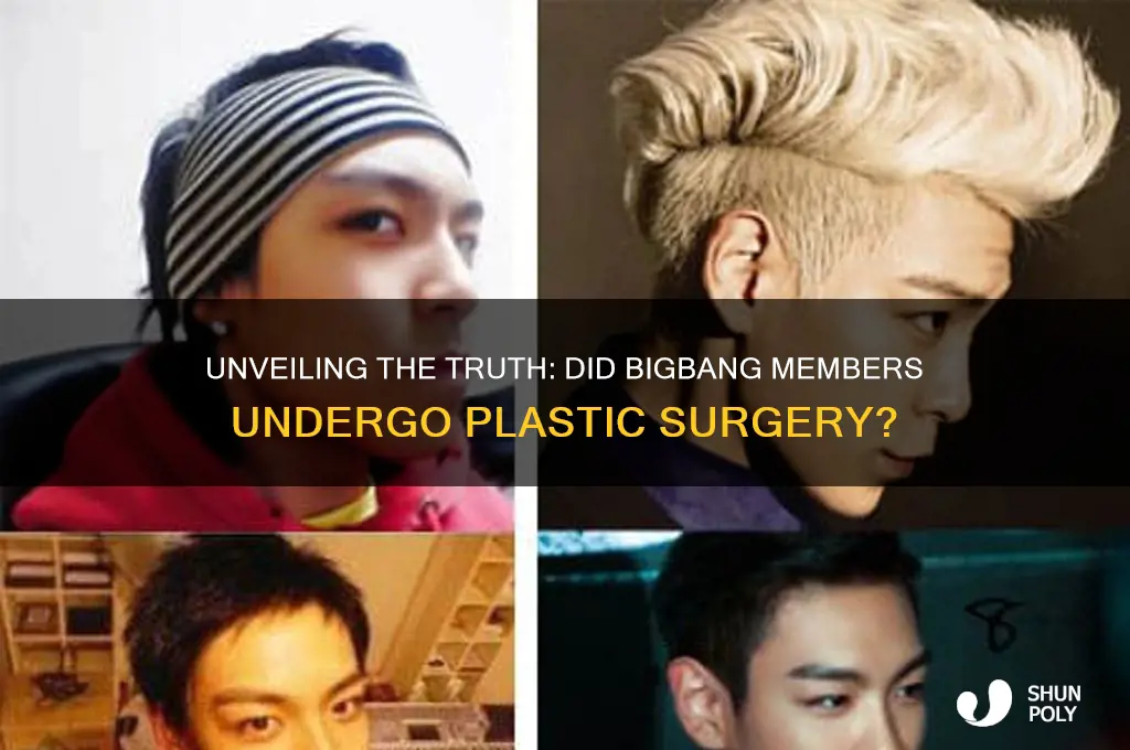 did bigbang have plastic surgery