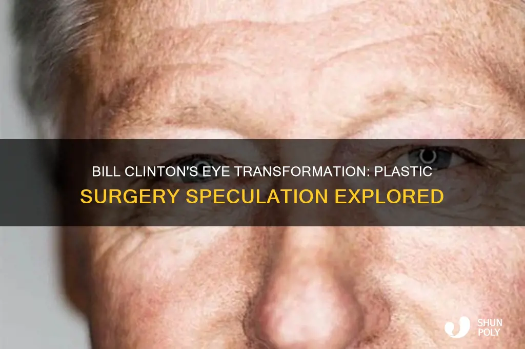 did bill clinton get plastic surgery on his eyes