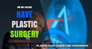 Did Bill Nelson Undergo Plastic Surgery? Unveiling the Truth