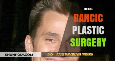 Bill Rancic Plastic Surgery: Fact or Fiction? Unveiling the Truth