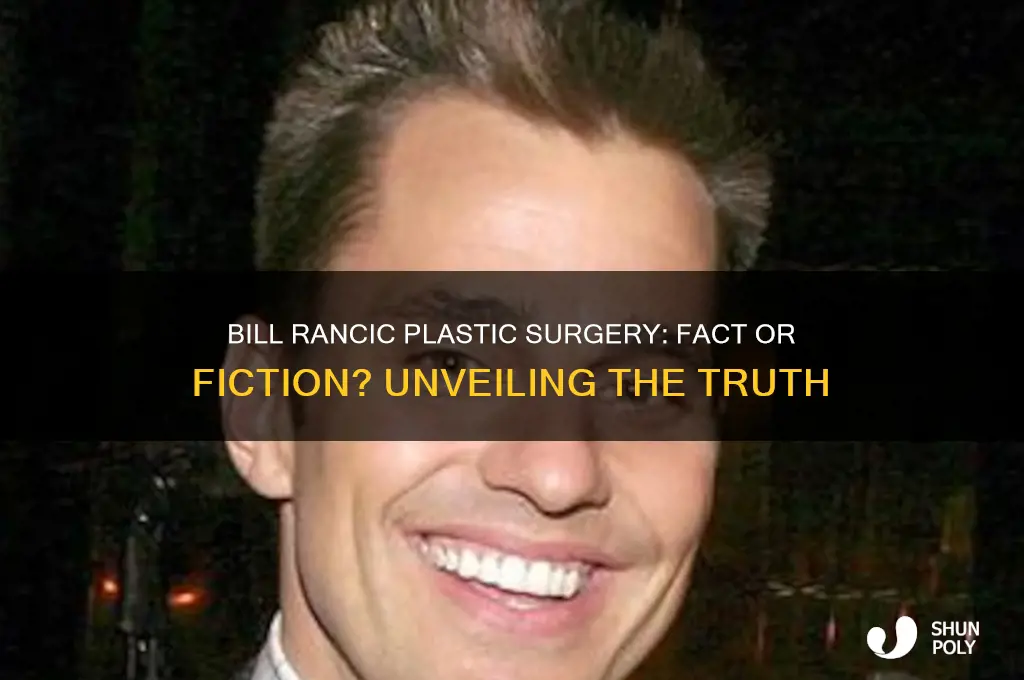 did bill rancic plastic surgery