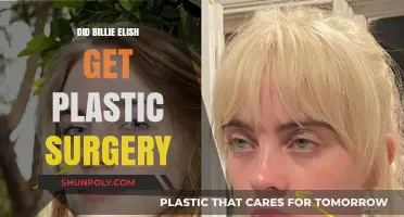 Billie Eilish Plastic Surgery Rumors: Fact or Fiction?