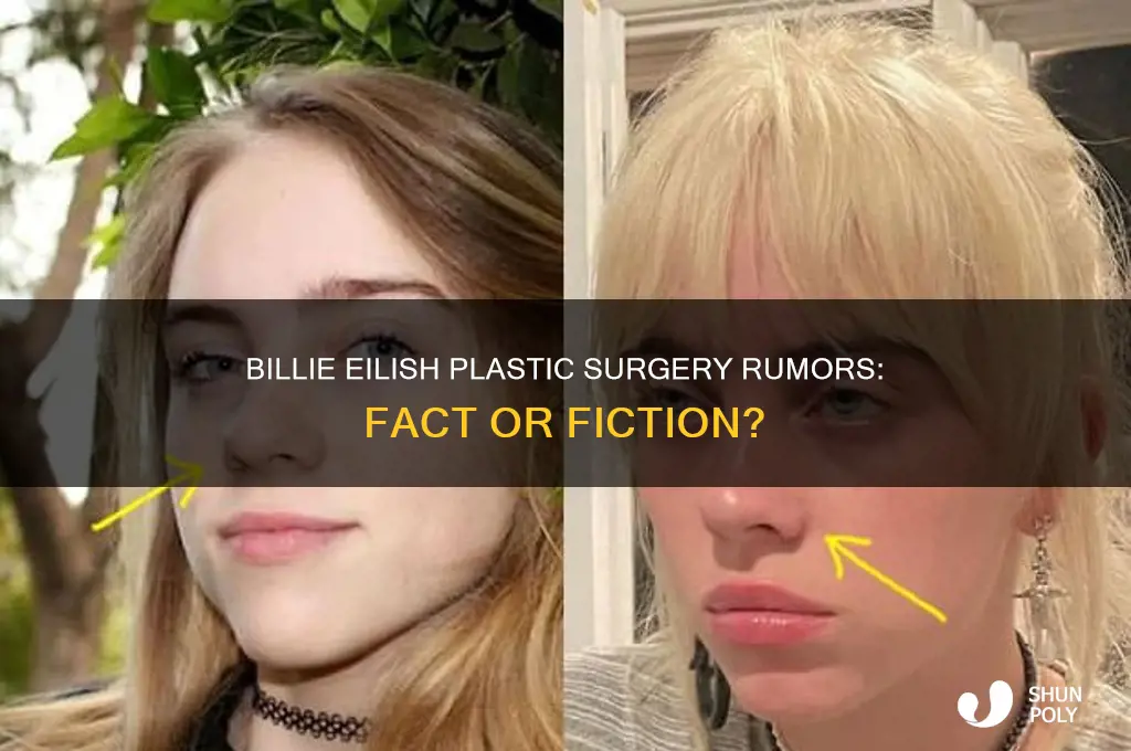 did billie elish get plastic surgery