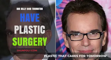 Billy Bob Thornton's Transformation: Plastic Surgery Speculations Explored