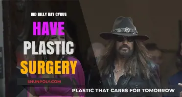 Billy Ray Cyrus Plastic Surgery: Fact or Fiction?