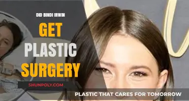 Bindi Irwin Plastic Surgery Rumors: Fact or Fiction?