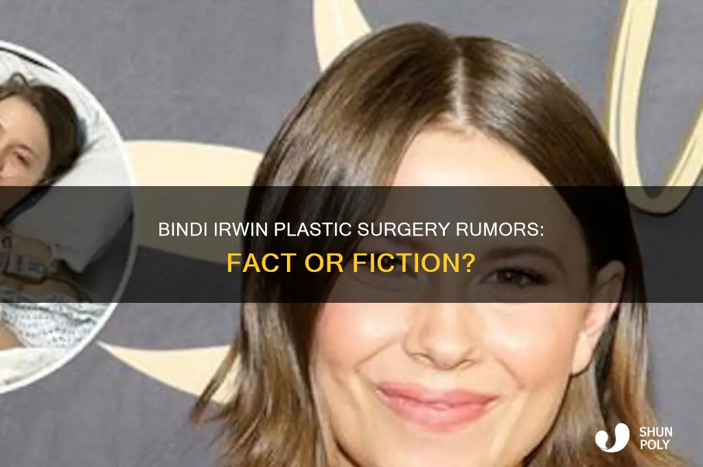 did bindi irwin get plastic surgery