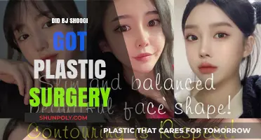 Did BJ Shoogi Undergo Plastic Surgery? Unveiling the Truth