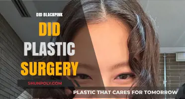 Blackpink Plastic Surgery Rumors: Fact-Checking the K-Pop Phenomenon