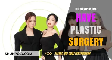Unveiling the Truth: Lisa of BLACKPINK and Plastic Surgery Rumors