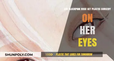 Did Blackpink's Rosé Undergo Eye Plastic Surgery? The Truth Revealed