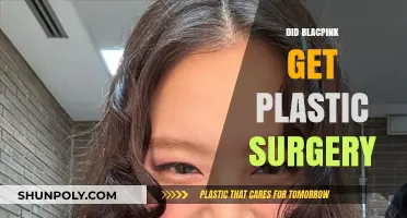 Unveiling the Truth: Blacpink's Plastic Surgery Speculations Explored
