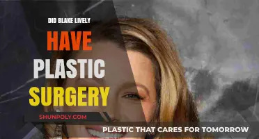 Blake Lively's Transformation: Plastic Surgery Rumors Explored and Debunked
