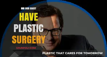 Bob Saget Plastic Surgery: Unraveling the Truth Behind His Appearance