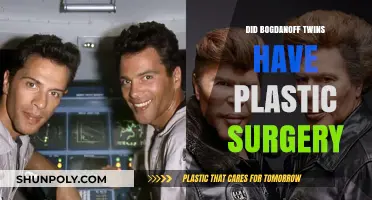 Bogdanoff Twins' Plastic Surgery: Fact or Fiction?