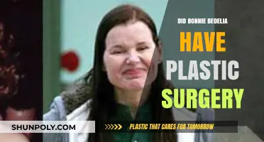 Bonnie Bedelia's Transformation: Plastic Surgery Speculations and Truths