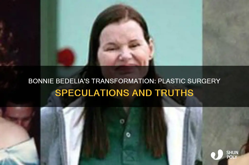 did bonnie bedelia have plastic surgery
