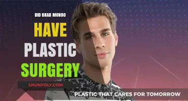 Brad Mondo Plastic Surgery: Fact-Checking the Rumors and Speculations