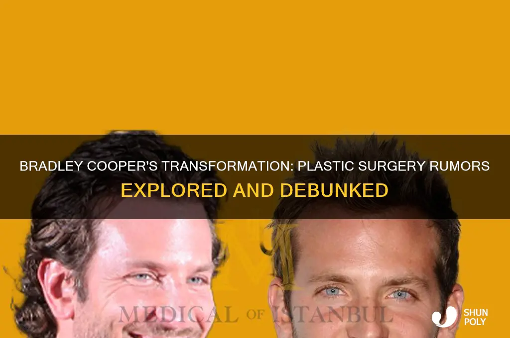 did bradley cooper get plastic surgery